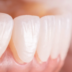 Oral Care Basics: Why Proper Hygiene is Key to a Healthy Mouth and Body
