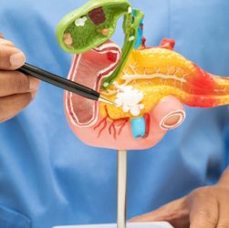 Gallbladder Surgery