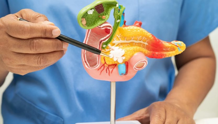 Gallbladder Surgery